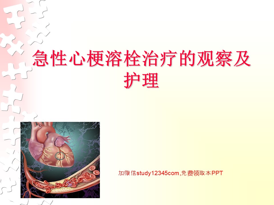 急性心梗溶栓治疗的观察及护理PPT