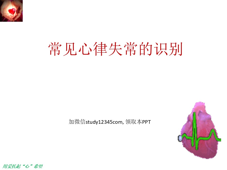 常见心律失常的识别PPT