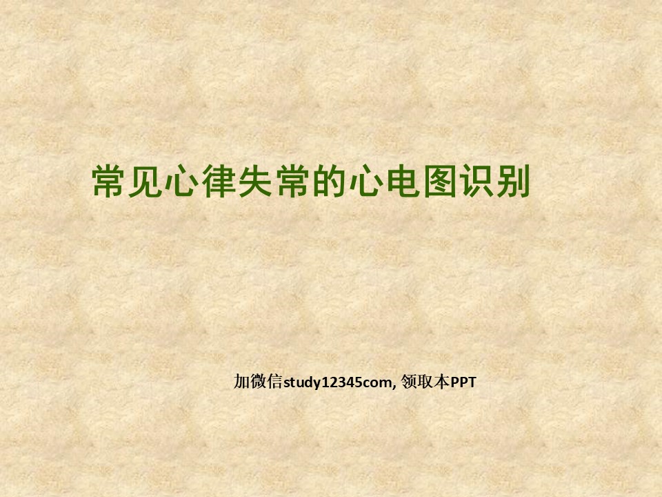 常见心律失常的心电图识别PPT