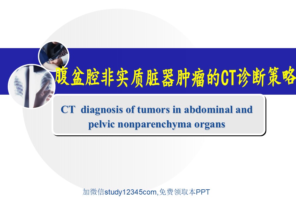 腹盆腔非实质脏器肿瘤的影像诊断PPT