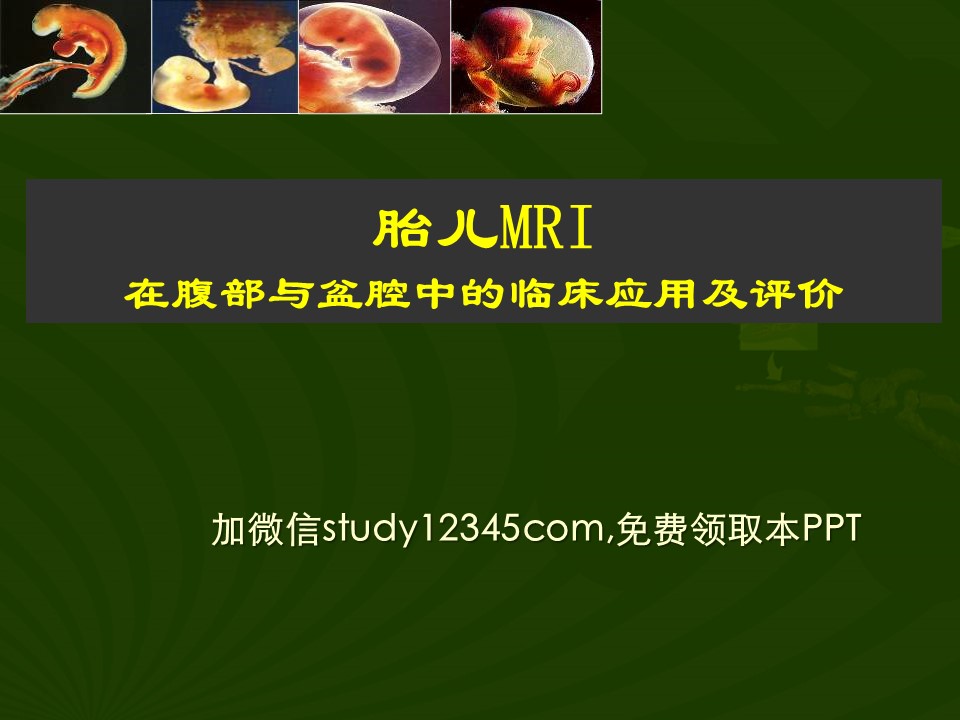 胎儿MRI在腹部与盆腔中的临床应用及评价
