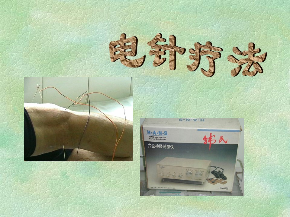 电针疗法PPT