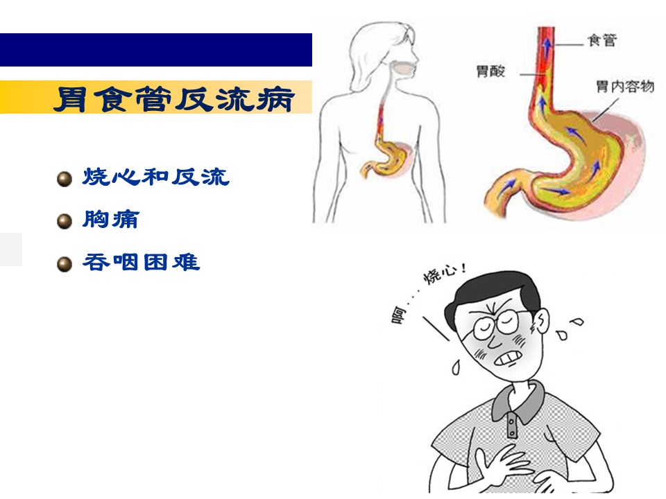 消化系统疾病2PPT